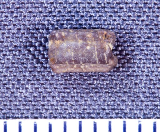 Orodus ? parallelus St.John & Worthen
