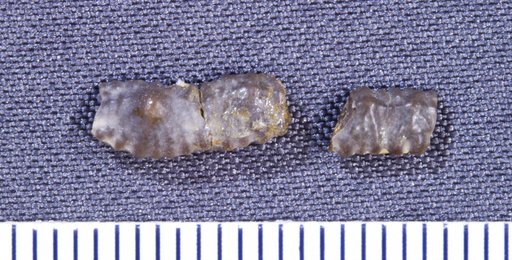 Orodus decussatus St.John & Worthen