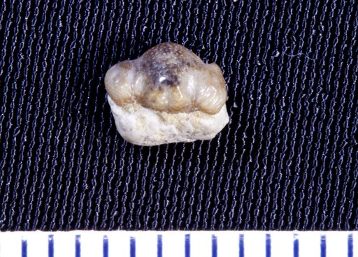 Orodus variocostatus St.John & Worthen