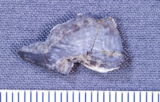 Cochliodus van hornii St.John & Worthen