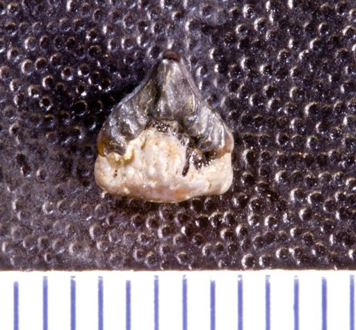 Orodus fastigiatus St.John & Worthen