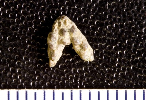 Stemmatodus bifurcatus St.John & Worthen