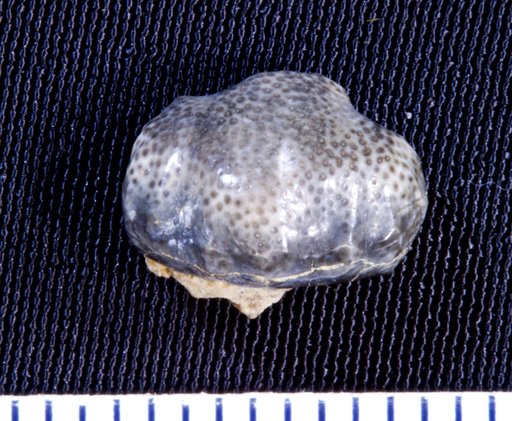 Orodus variocostatus St.John & Worthen