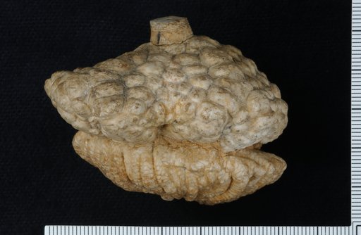 Forbesiocrinus burlingtonensis Springer