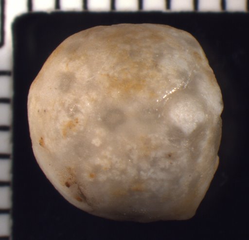 Thalamocrinus globosus Springer