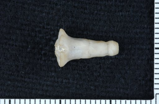 Synbathocrinus antiquus Strimple