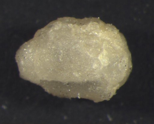Allagecrinus sculptus Strimple & Koenig