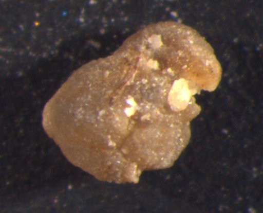 Trophocrinusinus variabilisis Strimple & Koenig