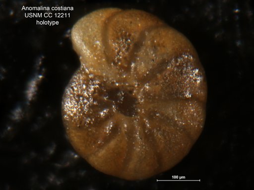 Anomalina costiana Weinzierl & Applin, 1929