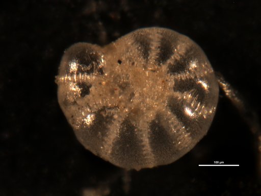 Elphidium oceanicum Cushman, 1933