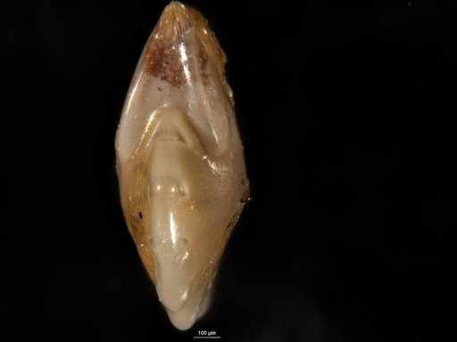 Robulus pondi Cushman, 1931