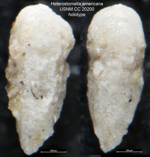 Heterostomella americana Cushman, 1936