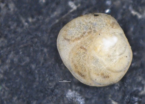 Discorbis bertheloti var. floridensis Cushman, 1931