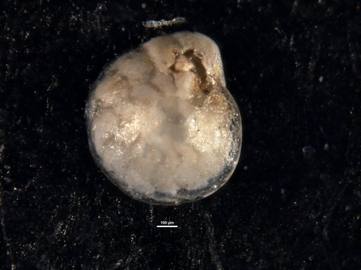 Amphistegina chipolensis Cushman & Ponton, 1932