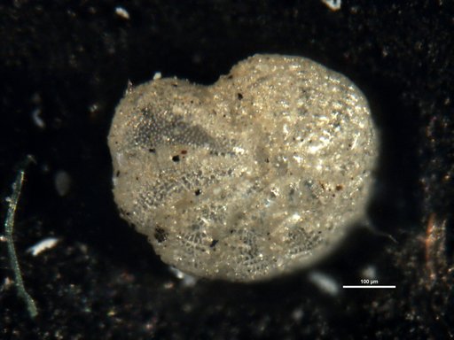Elphidium hispidulum Cushman, 1936