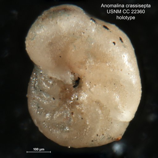 Anomalina crassisepta Cushman & Siegfus, 1935