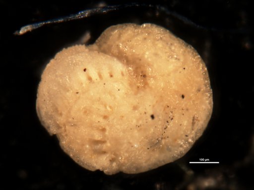 Elphidium pseudoinflatum Cushman, 1936