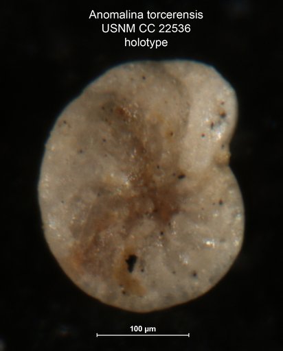 Anomalina torcerensis Albritton, 1937