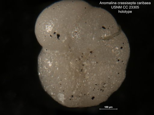 Anomalina crassisepta var. caribaea Cushman & Bermudez, 1936