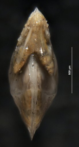 Robulus navarroensis var. extruatas Cushman, 1938
