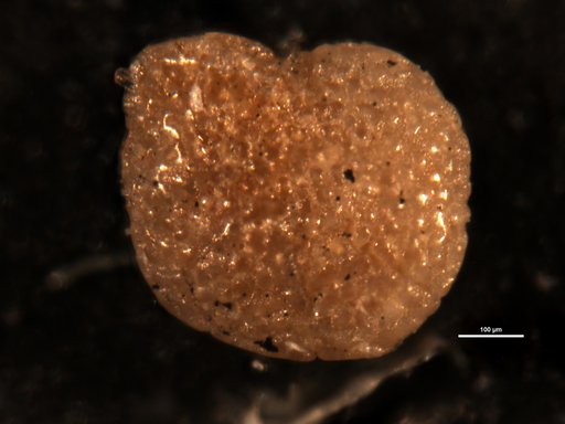 Elphidium papillosum Cushman, 1936