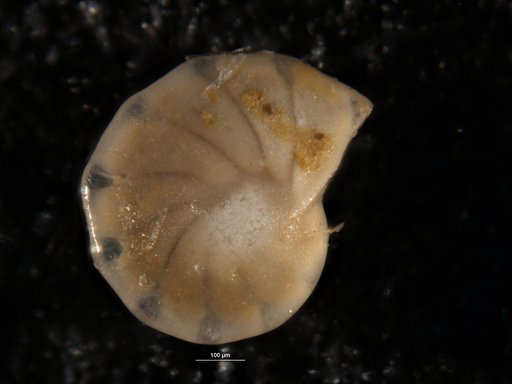Robulus pondi Cushman, 1931