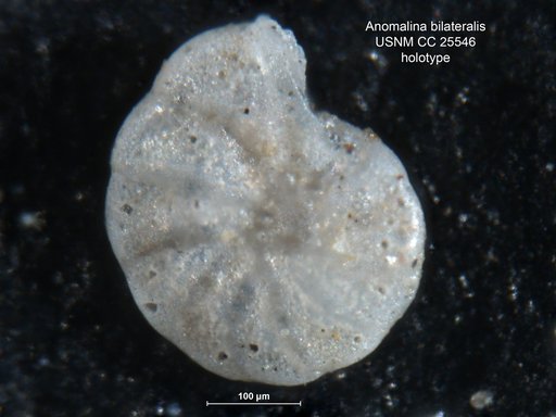 Anomalina bilateralis Cushman, 1922