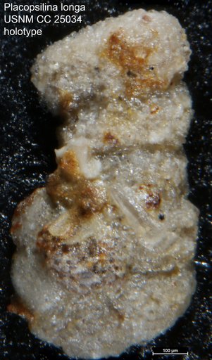 Placopsilina longa Tappan Loeblich, 1940