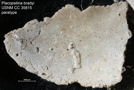 Placopsilina bradyi Cushman & McCulloch, 1939