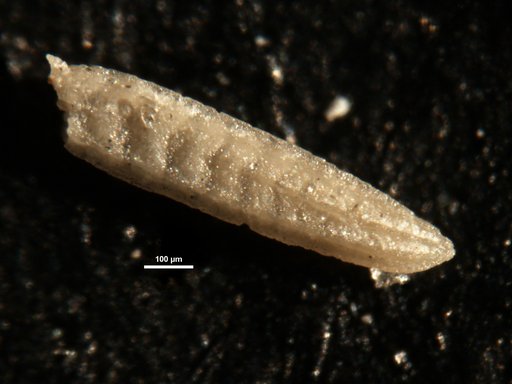 Plectofrondicularia pohana Finlay, 1939