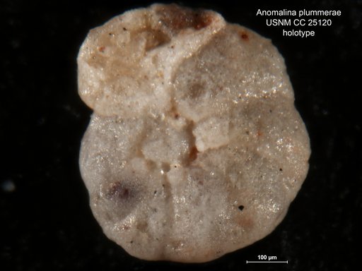 Anomalina plummerae Tappan Loeblich, 1940