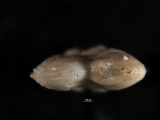 Robulus nuttalli var. obliquicostata Cushman & Renz, 1941