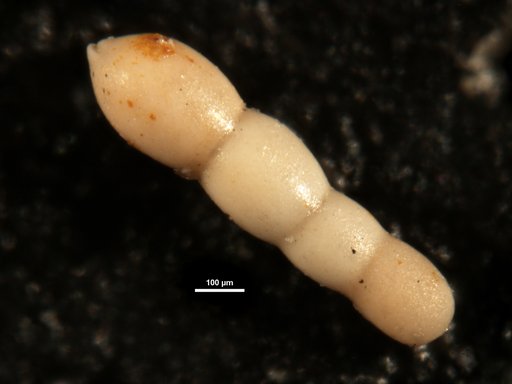 Nodosarella advena Cushman & Siegfus, 1939
