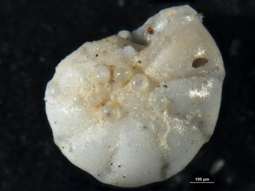 Robulus gutticostatus var. yazooensis Cushman, 1933