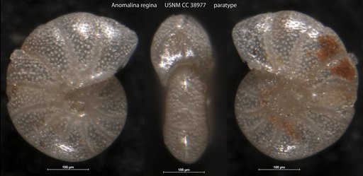 Anomalina regina Martin, 1943