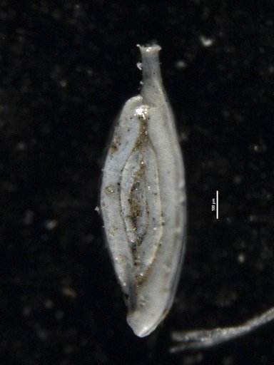 Spiroloculina attenuata Cushman & Todd, 1944