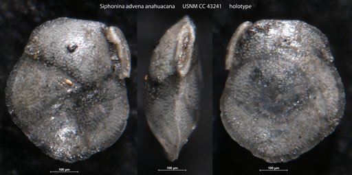 Siphonina advena var. anahuacana Cushman & Ellisor, 1945