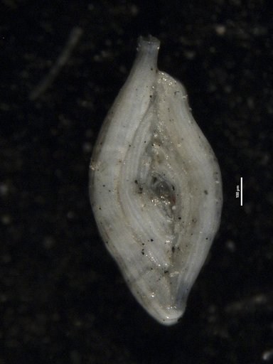 Spiroloculina corrugata Cushman & Todd, 1944