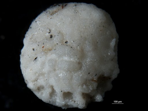 Amphistegina alabamensis Applin & Jordan, 1945