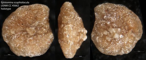 Epistomina scaphiolocula Loeblich & Tappan Loeblich, 1946