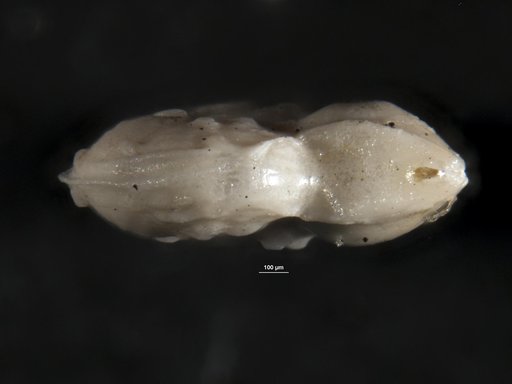 Robulus nuttalli var. obliquicostata Cushman & Renz, 1941
