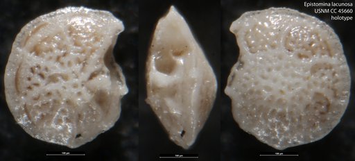 Epistomina lacunosa Loeblich & Tappan, 1946