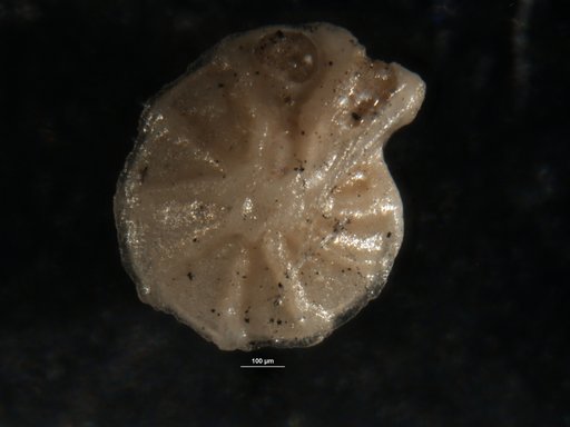 Robulus insuetus Cushman & Stainforth, 1947