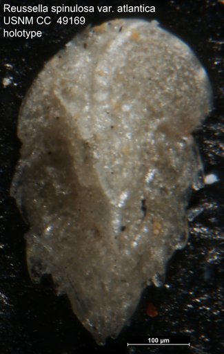 Reussella spinulosa var. atlantica Cushman, 1947