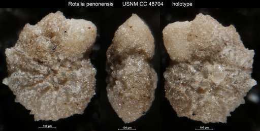 Rotalia penonensis Cushman & Bermúdez, 1947
