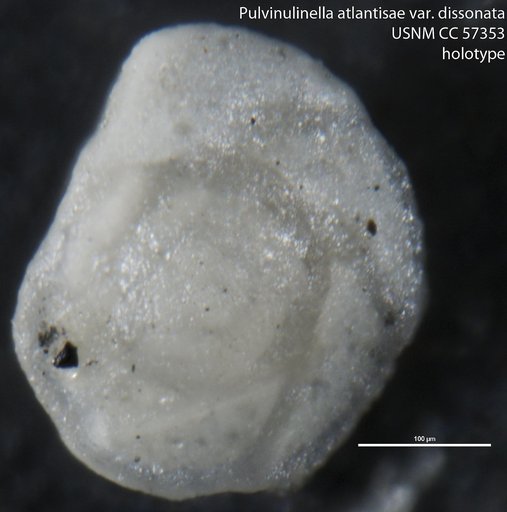 Pulvinulinella atlantisae var. dissonata Cushman & Renz, 1948