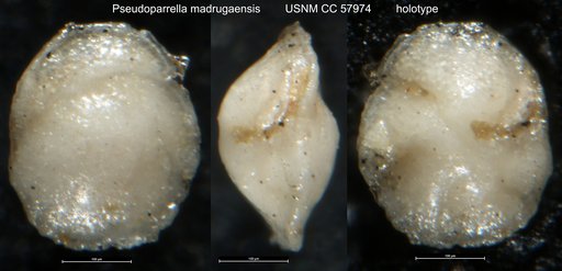Pseudoparrella madrugaensis Cushman & Bermudez, 1948