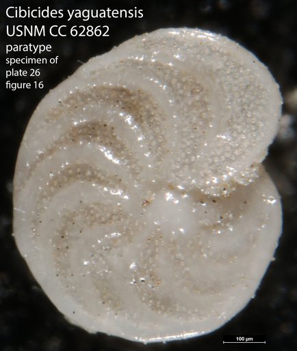 Cibicides yaguatensis Bermudez, 1949