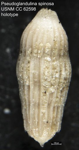 Pseudoglandulina spinosa Bermúdez, 1949