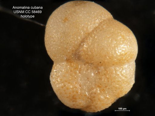 Anomalina cubana Cushman & Bermúdez, 1948